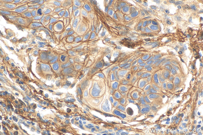 CD55 Antibody in Immunohistochemistry (Paraffin) (IHC (P))