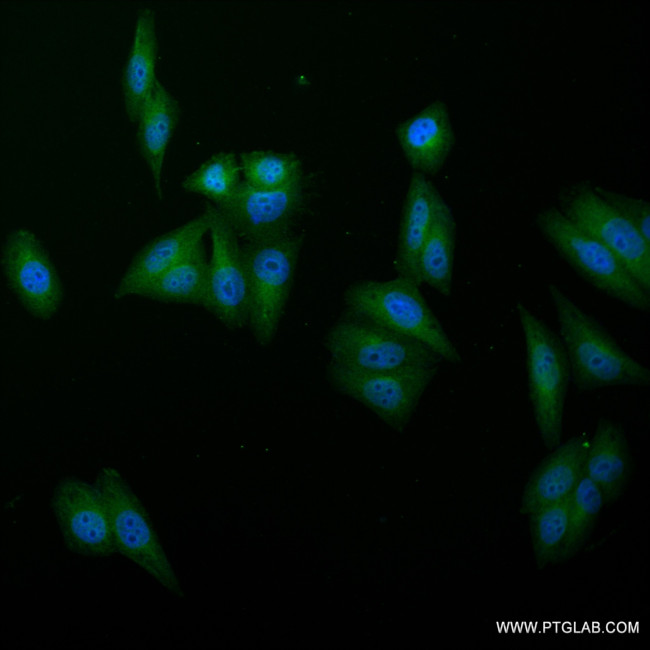 Albumin Antibody in Immunocytochemistry (ICC/IF)