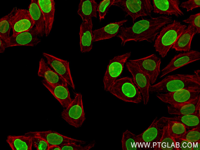 Lamin B2 Antibody in Immunocytochemistry (ICC/IF)