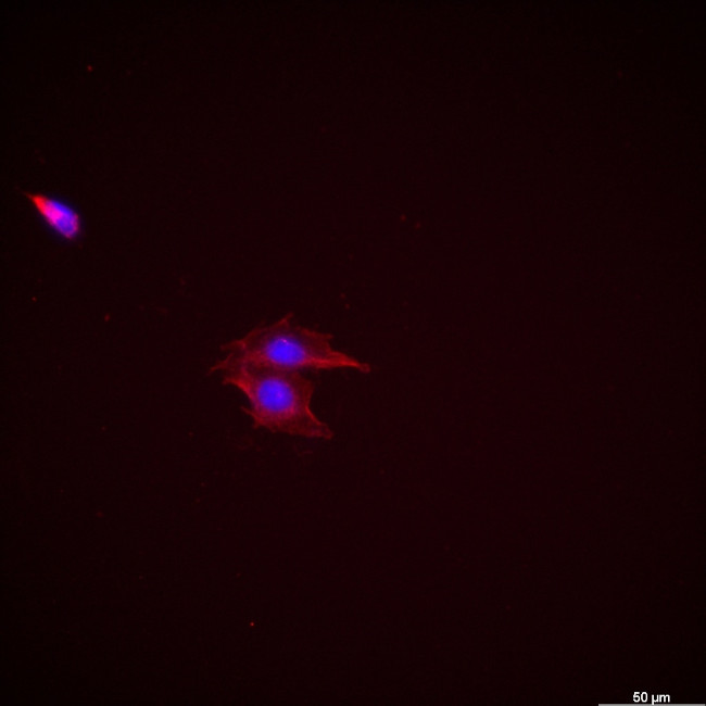 Calretinin Antibody in Immunocytochemistry (ICC/IF)