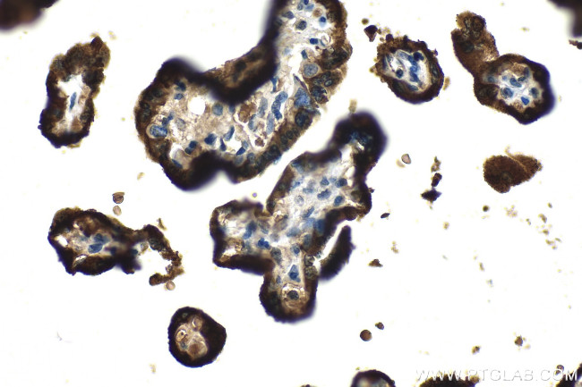 GH1 Antibody in Immunohistochemistry (Paraffin) (IHC (P))