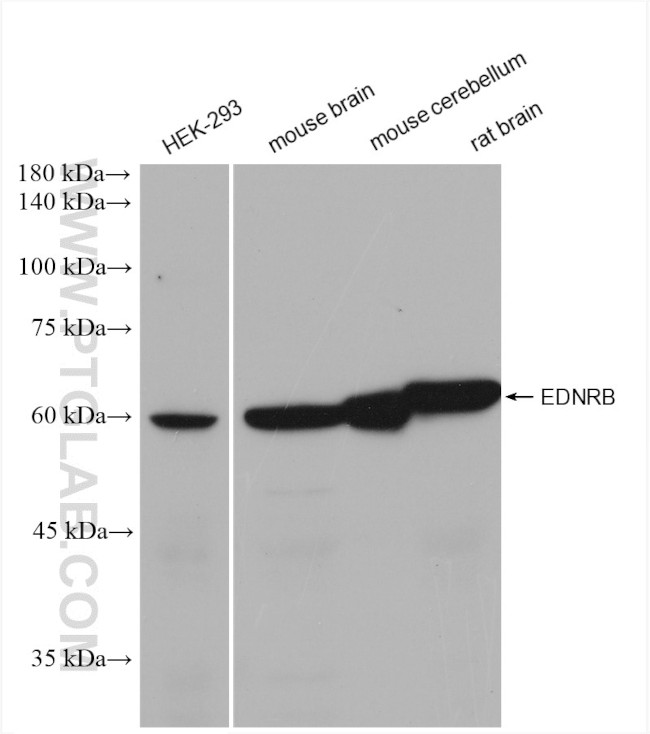 EDNRB Antibody in Western Blot (WB)