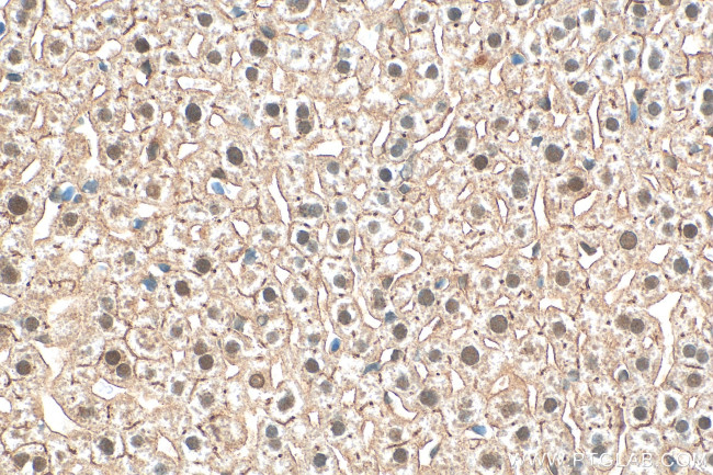 CLOCK Antibody in Immunohistochemistry (Paraffin) (IHC (P))