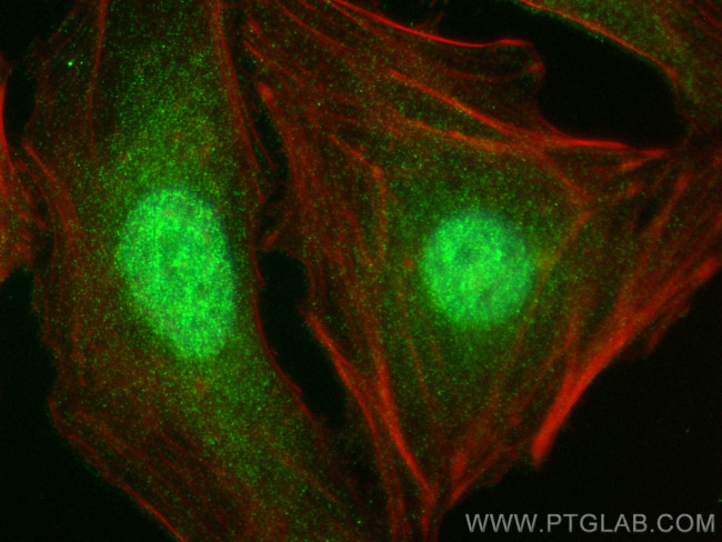 BACH1 Antibody in Immunocytochemistry (ICC/IF)