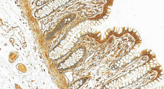 SEPT9 Antibody in Immunohistochemistry (Paraffin) (IHC (P))