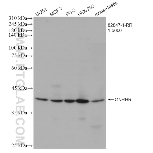 GNRHR Antibody in Western Blot (WB)