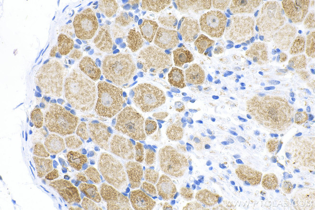 CHRNA7 Antibody in Immunohistochemistry (Paraffin) (IHC (P))