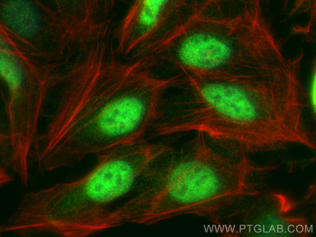 FBXO44 Antibody in Immunocytochemistry (ICC/IF)