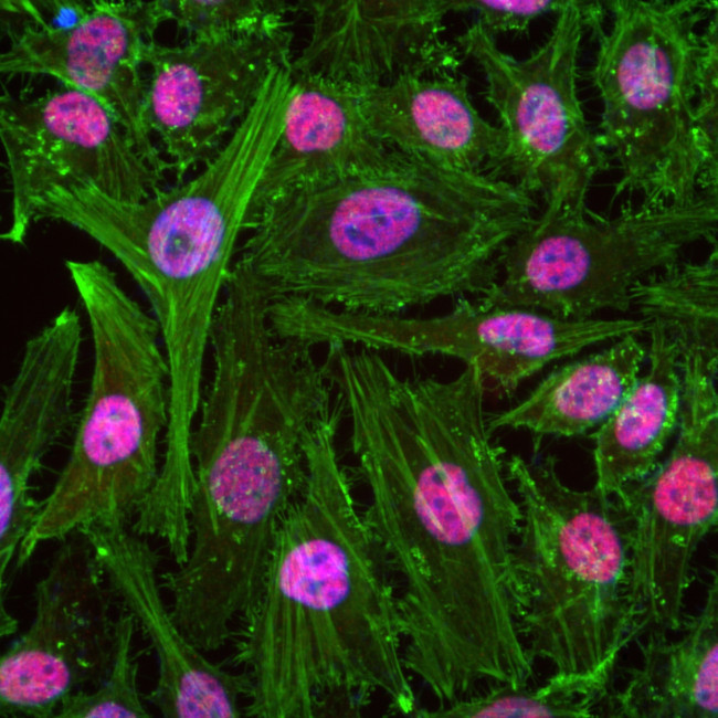 TAF15 Antibody in Immunocytochemistry (ICC/IF)