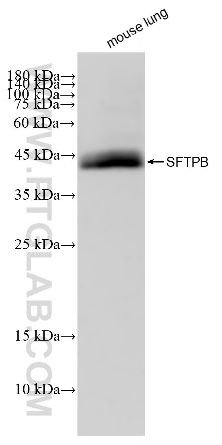 SFTPB Antibody in Western Blot (WB)