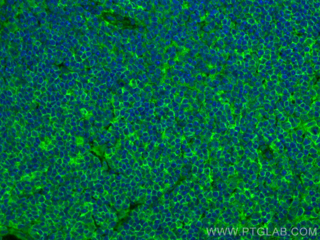 NOX2 Antibody in Immunohistochemistry (PFA fixed) (IHC (PFA))