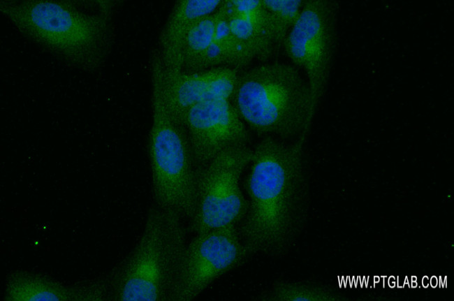 SHPK Antibody in Immunocytochemistry (ICC/IF)