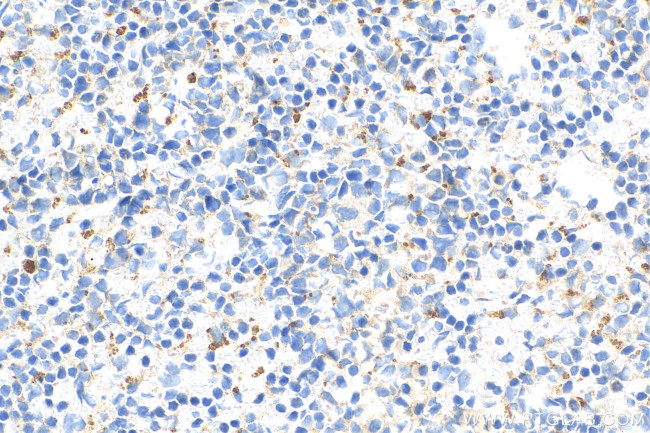 OAS1 Antibody in Immunohistochemistry (Paraffin) (IHC (P))