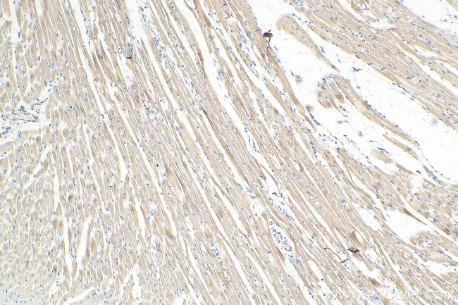 IFT88 Antibody in Immunohistochemistry (Paraffin) (IHC (P))