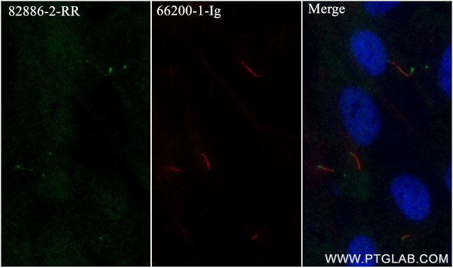 IFT88 Antibody in Immunocytochemistry (ICC/IF)