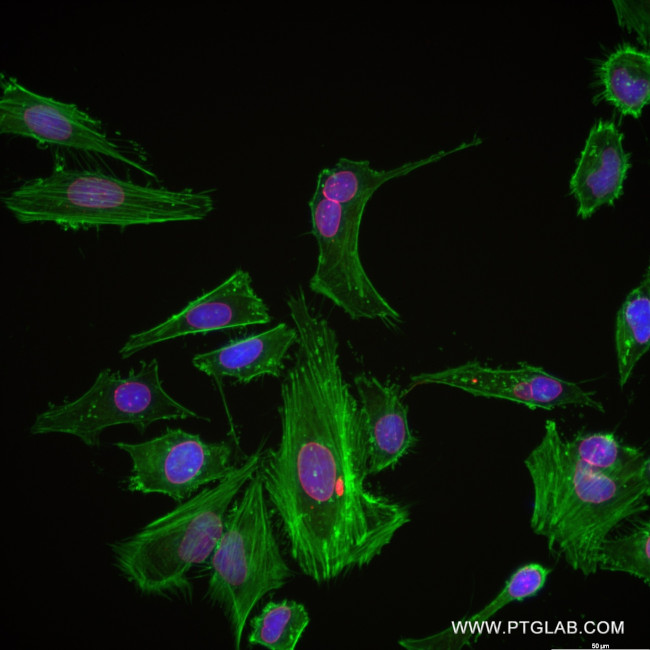 Emerin Antibody in Immunocytochemistry (ICC/IF)
