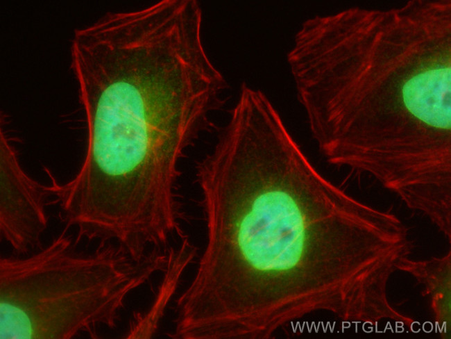 Emerin Antibody in Immunocytochemistry (ICC/IF)