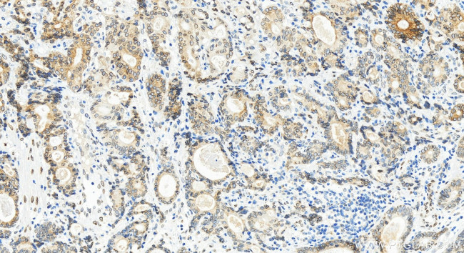 Emerin Antibody in Immunohistochemistry (Paraffin) (IHC (P))