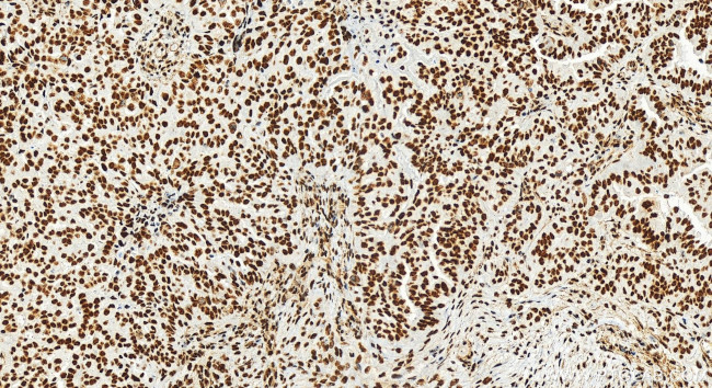 RBM17 Antibody in Immunohistochemistry (Paraffin) (IHC (P))