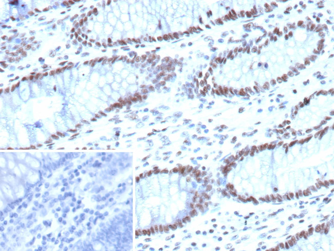 ARID1A/SMARCF1 Antibody in Immunohistochemistry (Paraffin) (IHC (P))