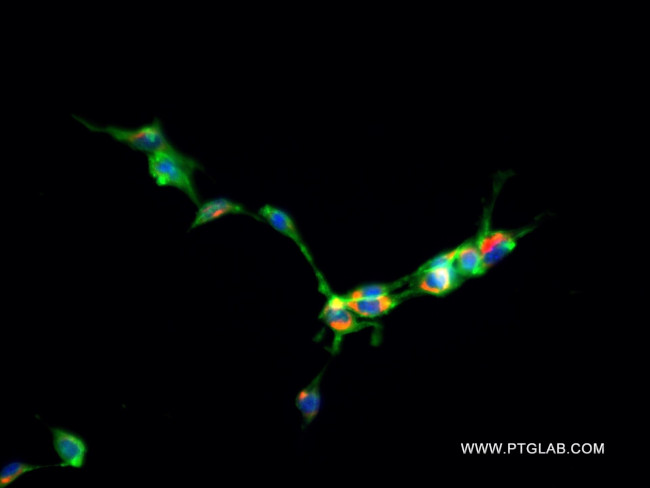 RRBP1 Antibody in Immunocytochemistry (ICC/IF)