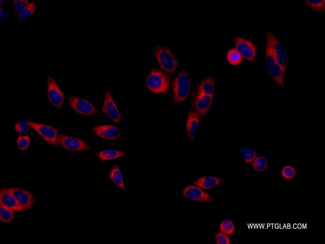 RRBP1 Antibody in Immunocytochemistry (ICC/IF)