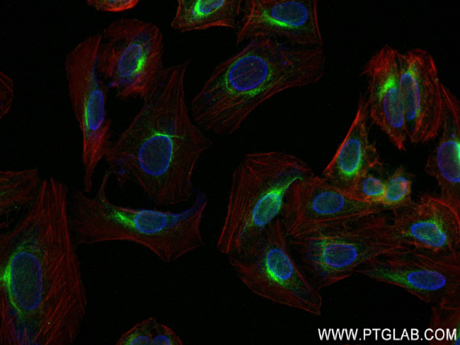 TRIM62 Antibody in Immunocytochemistry (ICC/IF)