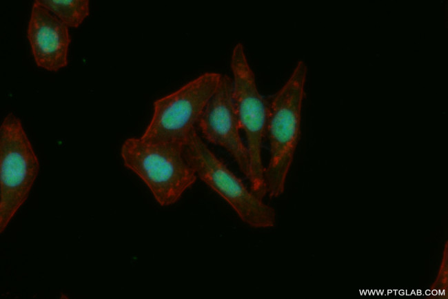 NSUN2 Antibody in Immunocytochemistry (ICC/IF)
