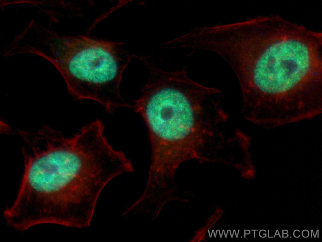 FANCM Antibody in Immunocytochemistry (ICC/IF)
