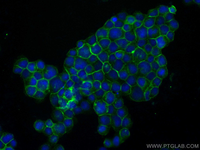 LAT Antibody in Immunocytochemistry (ICC/IF)