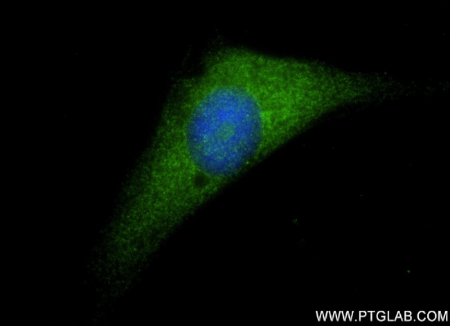 IL-18 Antibody in Immunocytochemistry (ICC/IF)