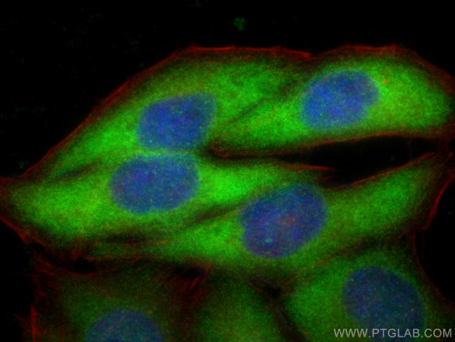 TBCD Antibody in Immunocytochemistry (ICC/IF)