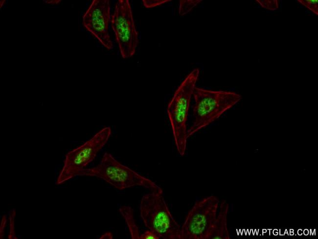 ZC3H11A Antibody in Immunocytochemistry (ICC/IF)