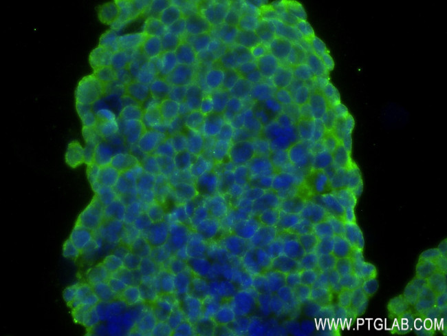 PARK7/DJ-1 Antibody in Immunocytochemistry (ICC/IF)