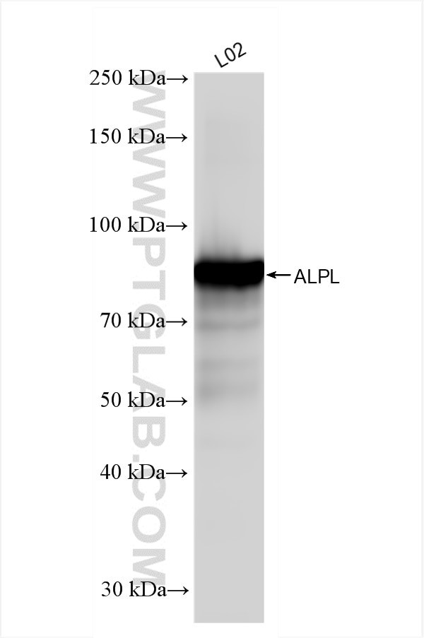 ALPL Antibody in Western Blot (WB)