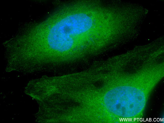 MYOF Antibody in Immunocytochemistry (ICC/IF)