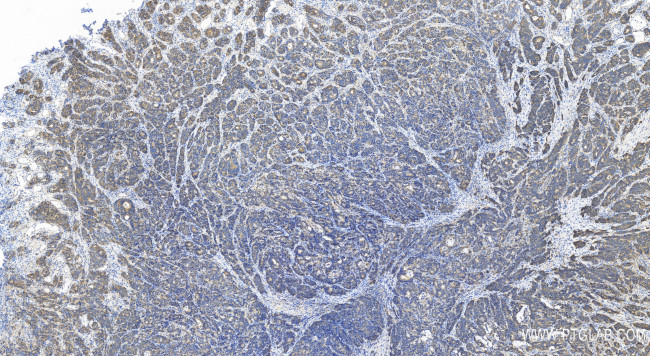 PICK1 Antibody in Immunohistochemistry (Paraffin) (IHC (P))