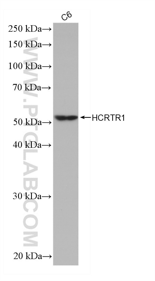 HCRTR1 Antibody in Western Blot (WB)
