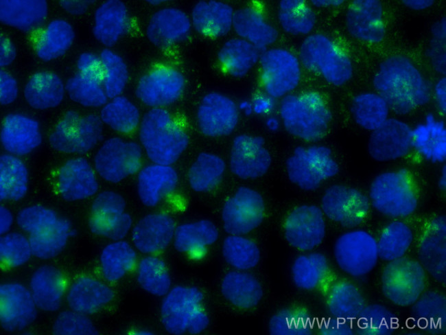 HLA-DMB Antibody in Immunocytochemistry (ICC/IF)