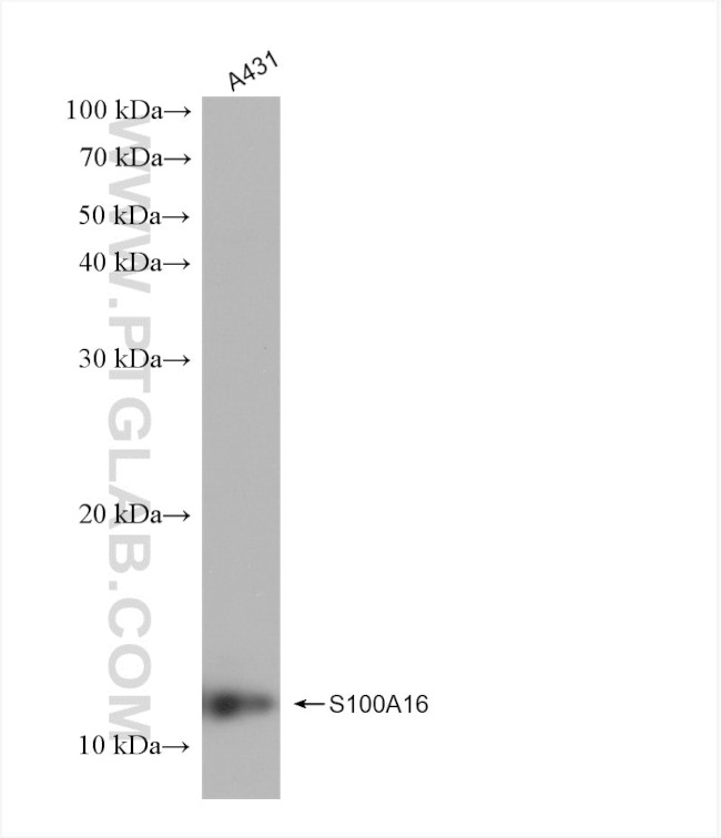 S100A16 Antibody in Western Blot (WB)