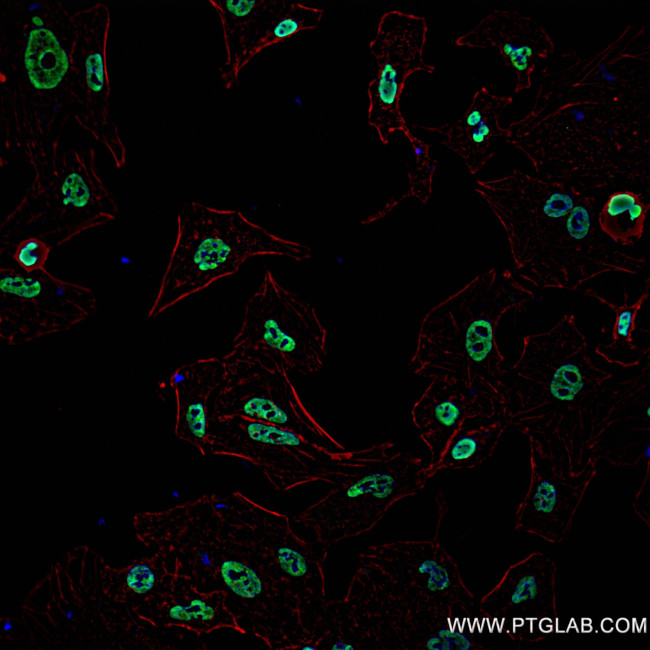 NFX1 Antibody in Immunocytochemistry (ICC/IF)