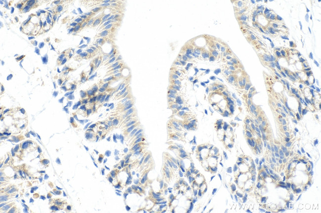 RNF160 Antibody in Immunohistochemistry (Paraffin) (IHC (P))