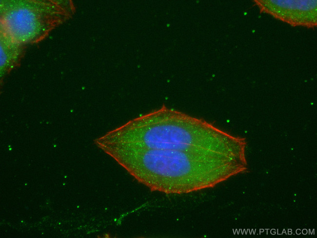 CYP7B1 Antibody in Immunocytochemistry (ICC/IF)
