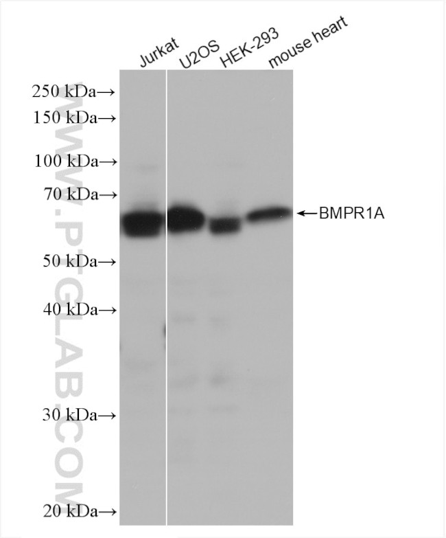 BMPR1A Antibody in Western Blot (WB)