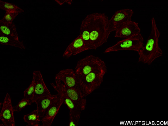 RORA Antibody in Immunocytochemistry (ICC/IF)