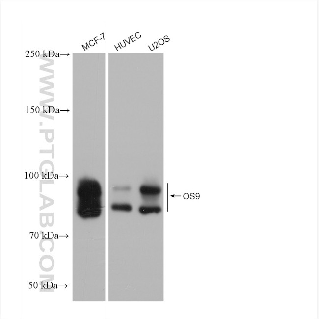 OS9 Antibody in Western Blot (WB)