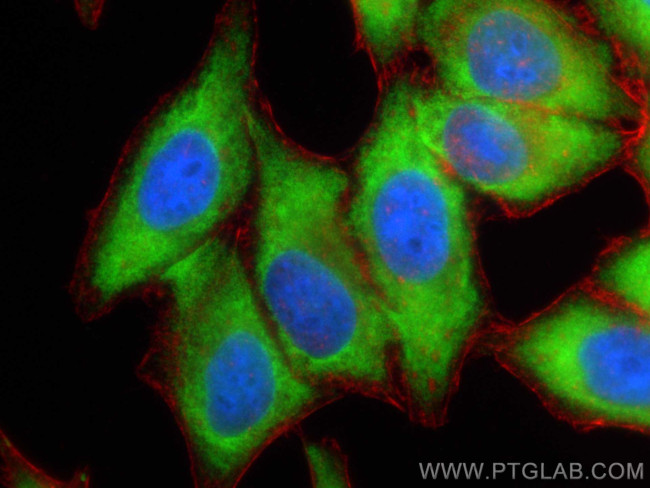 EIF2S1 Antibody in Immunocytochemistry (ICC/IF)