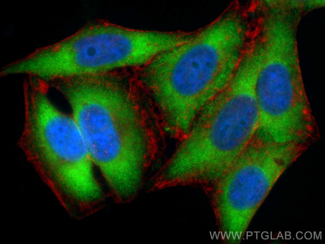 EIF2S1 Antibody in Immunocytochemistry (ICC/IF)