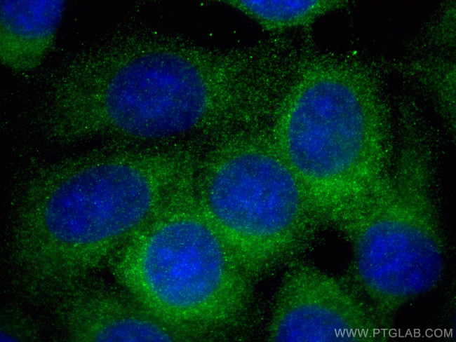 PI4KA Antibody in Immunocytochemistry (ICC/IF)