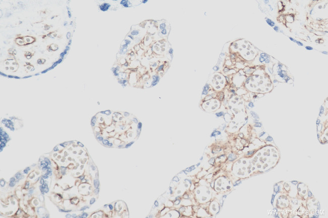 PDGFR beta Antibody in Immunohistochemistry (Paraffin) (IHC (P))